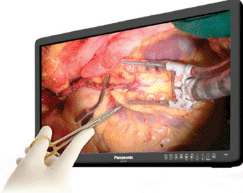 Imagen: El Monitor EJ-MDA32U-K3D de 32" de Panasonic, grado médico (Fotografía cortesía de Panasonic Corporation).